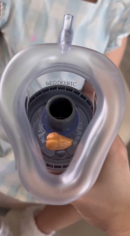 HomeHero Anti-Choke Device